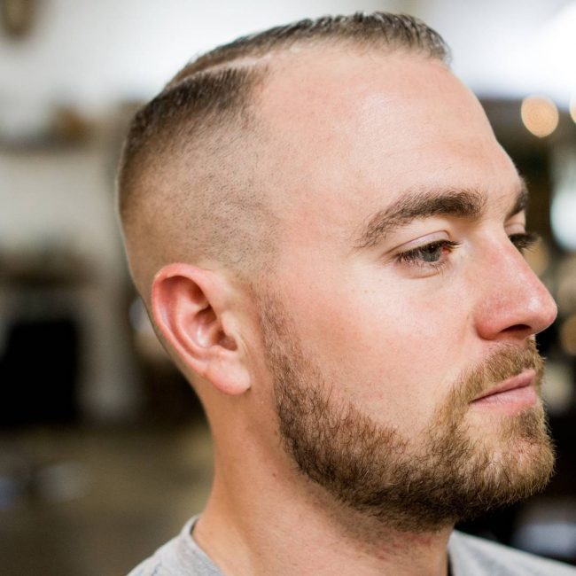 The Top 6 Haircuts for Balding Men - Chicago - Medical Man Cave